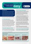 Pressure Ulcers and Hydrocolloids  Made Easy- Latin American Spanish